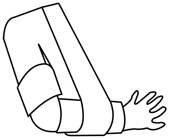injury